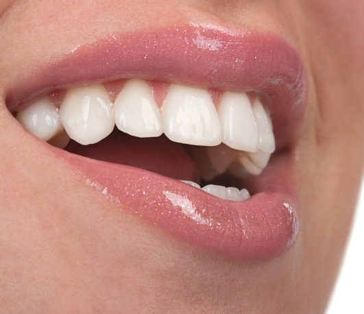 Close up of flawless smile with straight white teeth