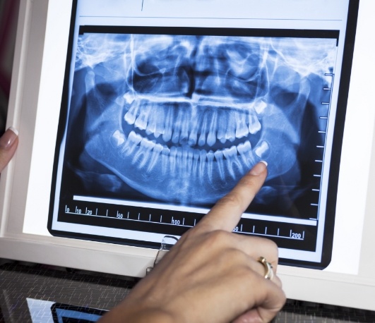 Dentist pointing to digital x ray of teeth