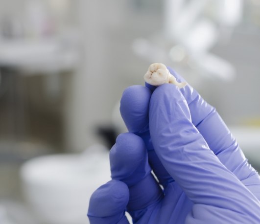 Gloved hand holding an extracted tooth