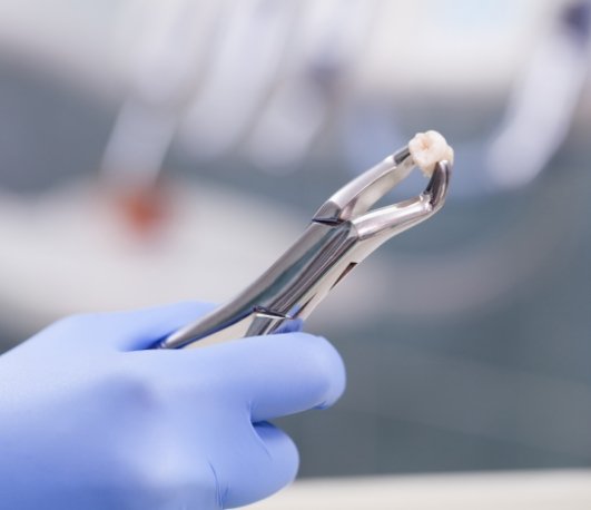 Dentist holding an extracted tooth with a clasp