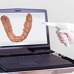 impression system