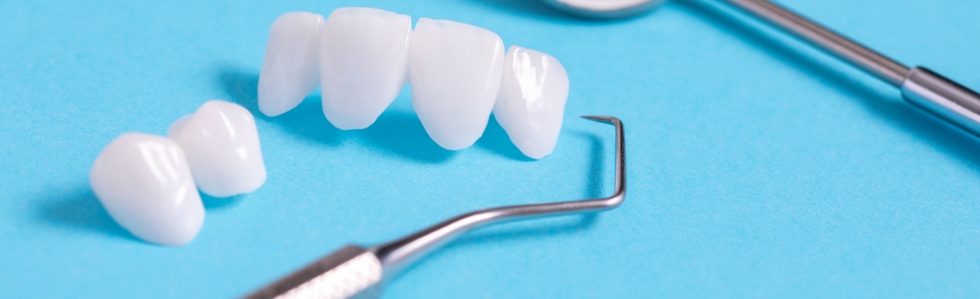 Several all ceramic dental restorations on desk next to dental scaler
