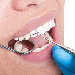smile getting scaled