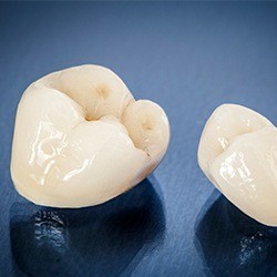 ceramic crown