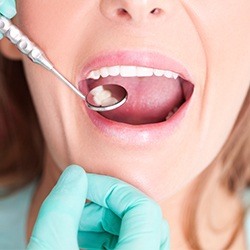 woman getting teeth checked
