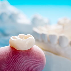 Dentist holding dental crown on finger