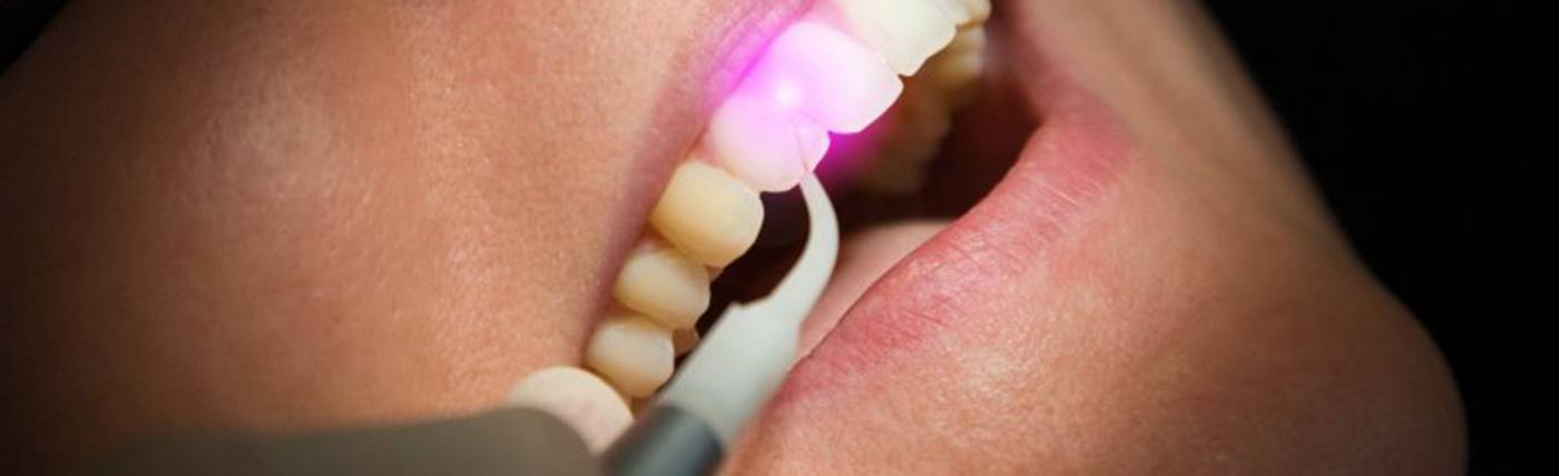 Close up of dentist using a dental laser on patient’s smile