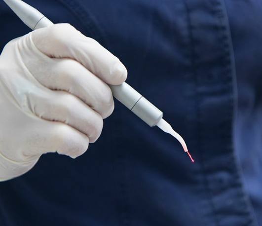 Dentist holding a dental laser