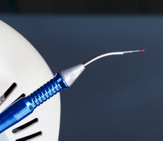 Close up of a dental laser