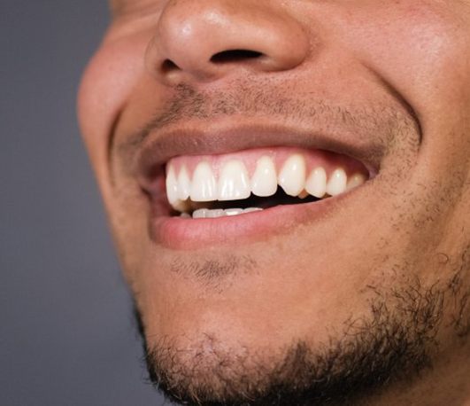 Close up of a patient’s bright smile