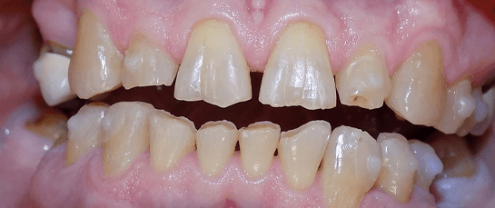 A smile before cosmetic work