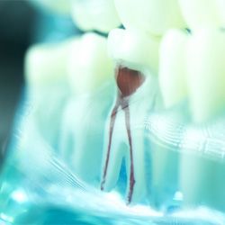 Model of a root canal