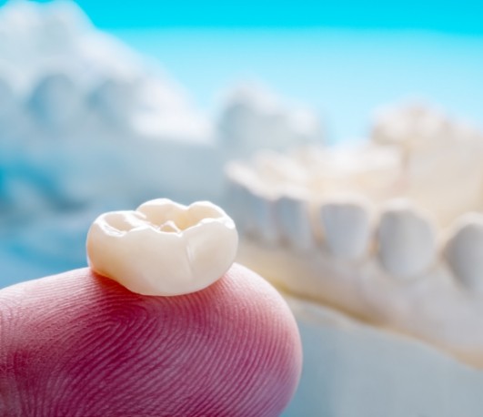 White dental crown resting on a finger