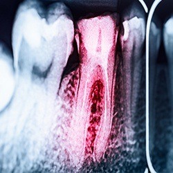 red tooth and roots
