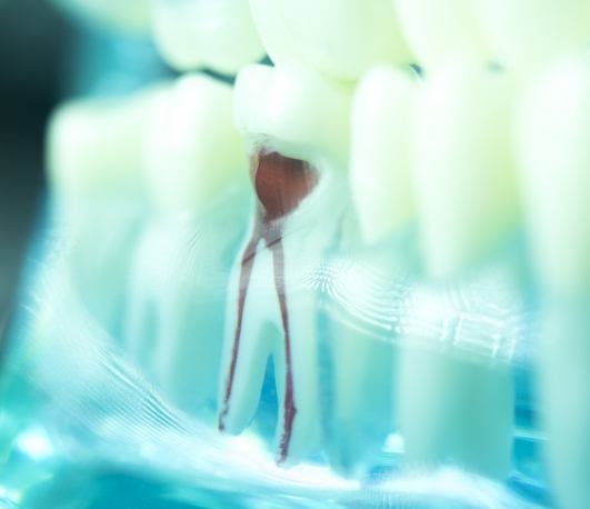 Model of tooth showing nerve pathways inside of it