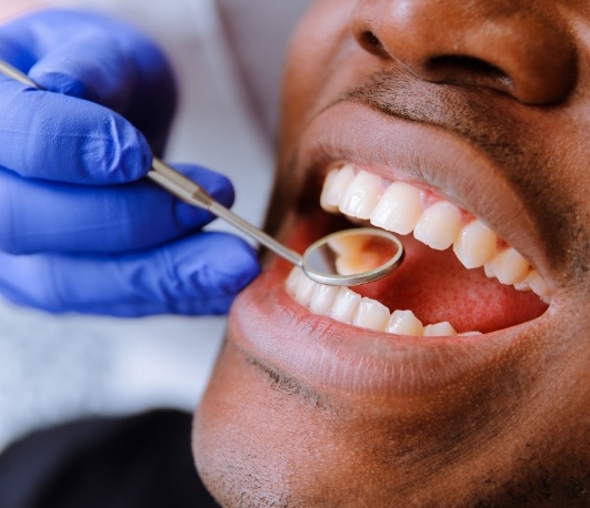 Close up of man receiving a dental exam