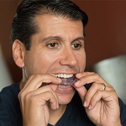 nightguards for Bruxism