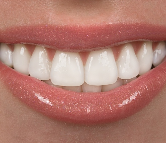 Close up of smile with straight white teeth