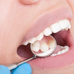 mirror showing top teeth