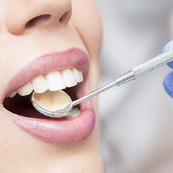 showing back of front teeth