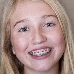 blonde girl with multiple colored braces