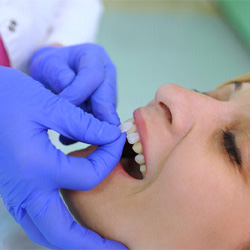 Man with orange question mark wonders about dental implants in Waco