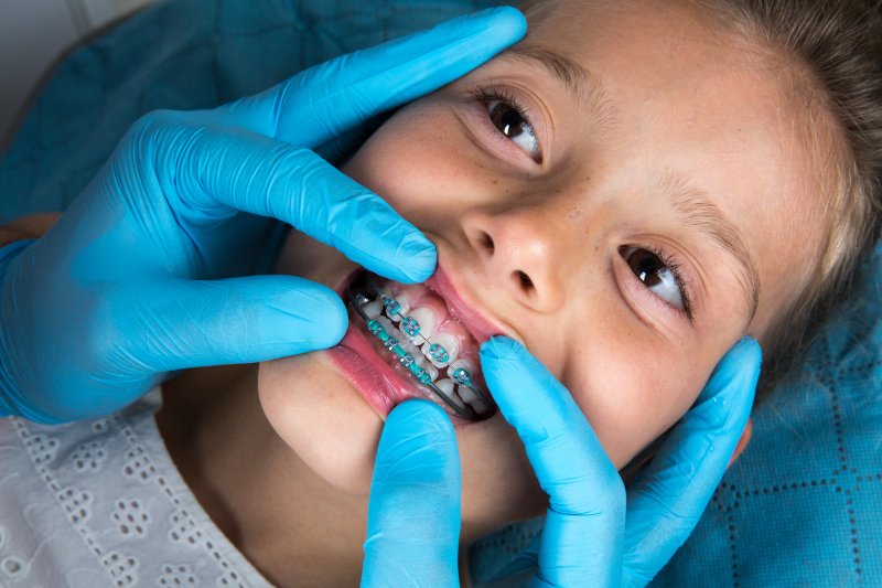 Closeup of young girl at orthodontist's appointment