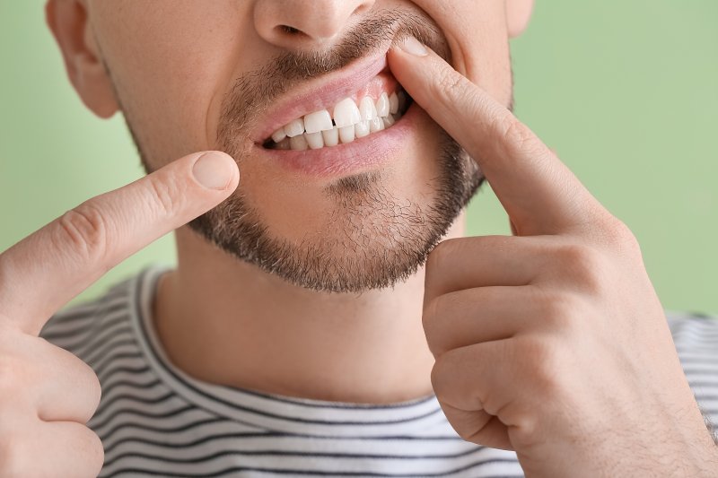 man showing his gums