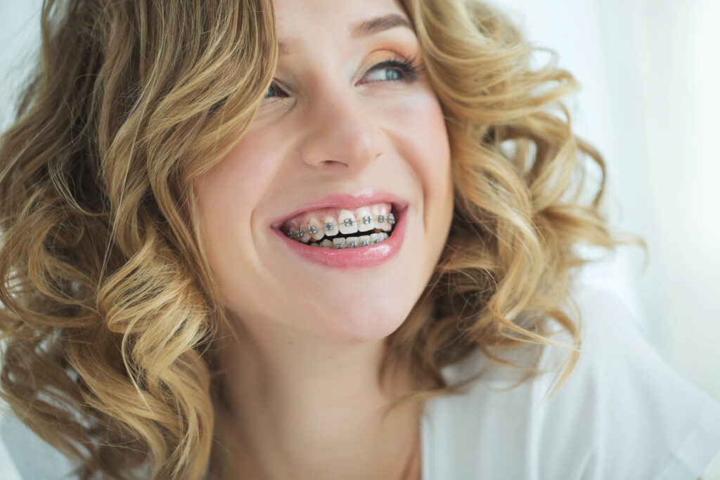 A girl smiling, her braces finally providing TMD relief