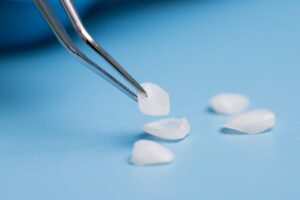 Dentist picking up a veneer