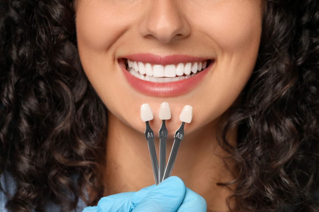 Nose to neck view of woman smiling with dentist holding shade guide to her teeth