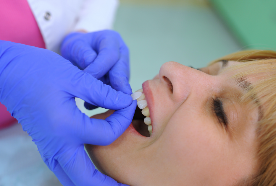 Woman getting fitted for veneers